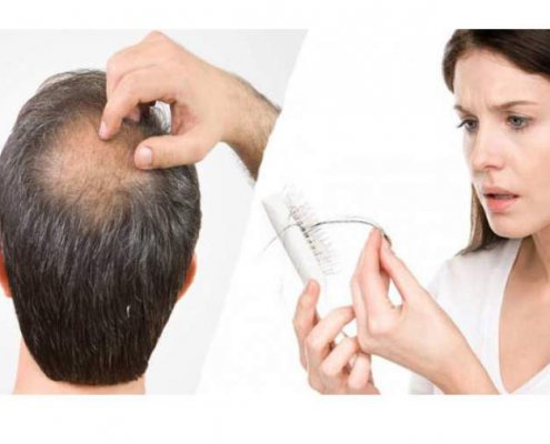 جلوگیری از ریزش مو